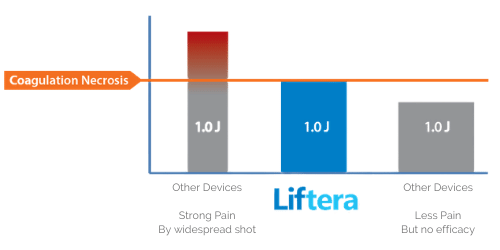 Why Liftera HIFU