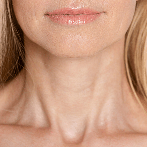 wrinkles lines on the neck