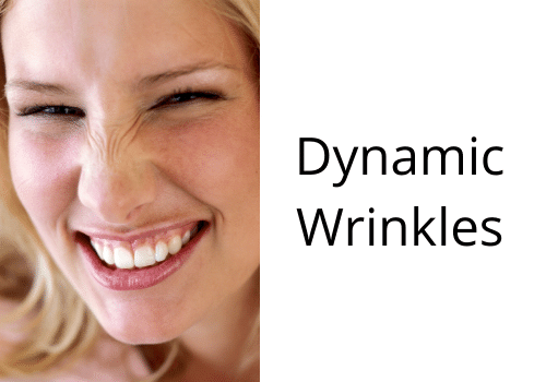 dynamic wrinkles