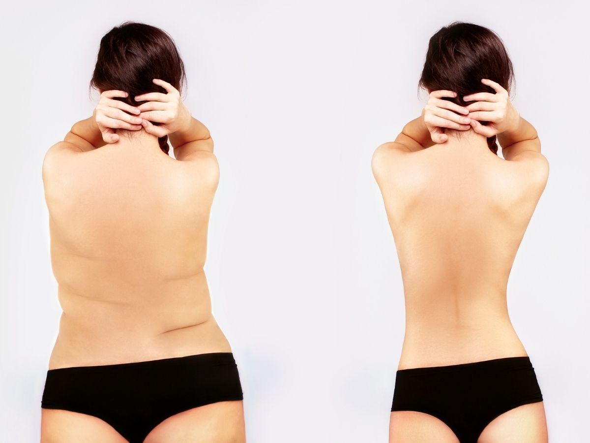 Weight Loss Singapore